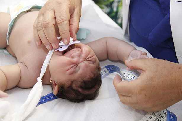 Governo Federal Lança Plano Que Beneficia Crianças Com Microcefalia Uai Saúde 7948