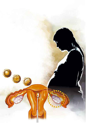 Arte: CB / D.A Press Arte: CB / D.A Press