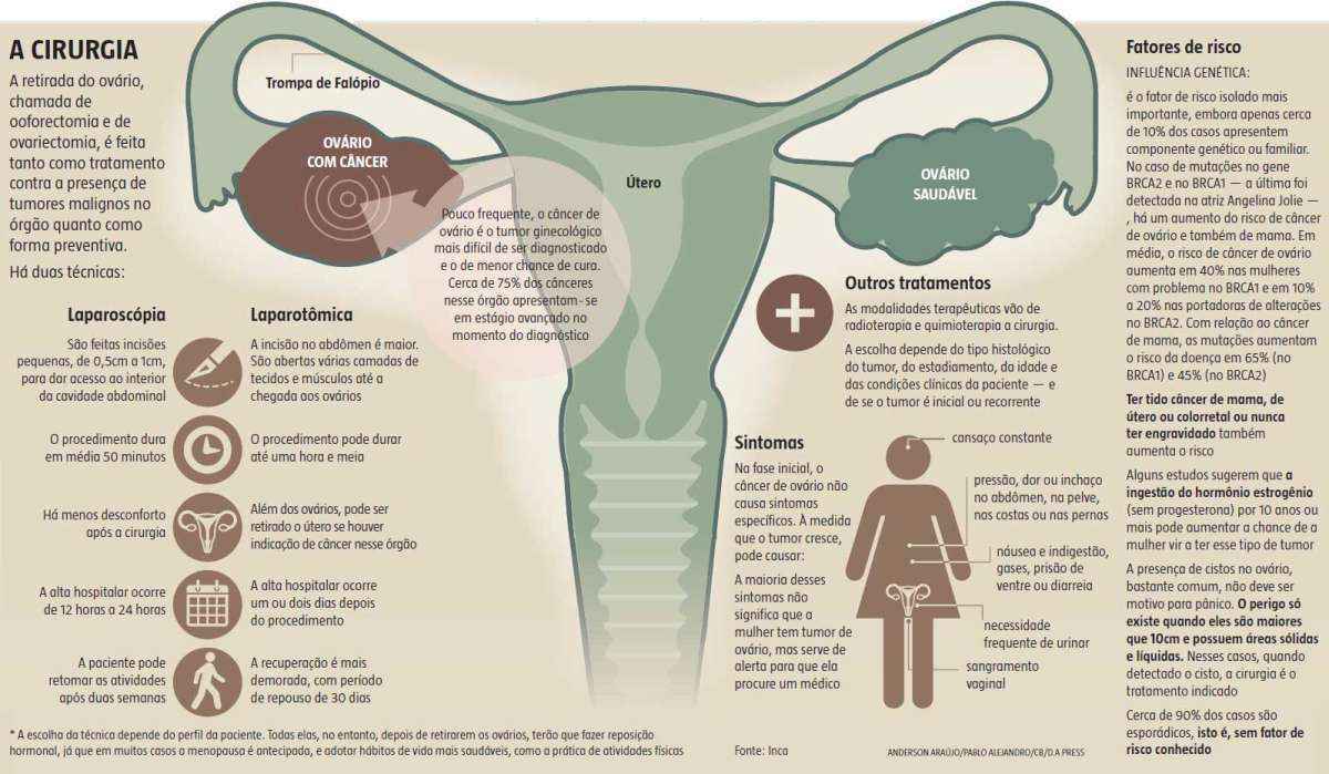 Ooforectomia: cirurgia para retirada dos ovários - Minha Vida