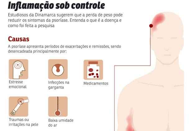 Clique para ampliar a imagem e saber mais sobre a relação entre psoríase e obesidade