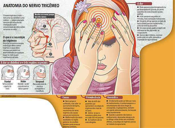 Nevralgia do Trigêmeo - Uma Grande Dor de Cabeça