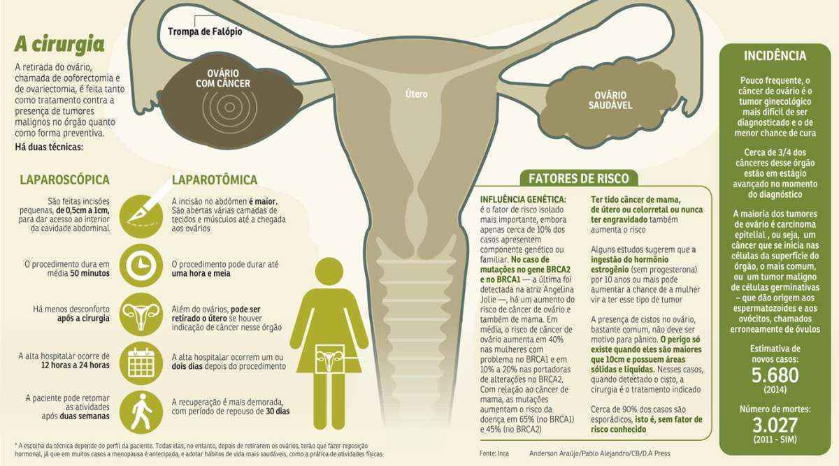 Ooforectomia: cirurgia para retirada dos ovários - Minha Vida