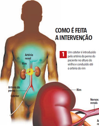 Clique para ampliar e saber mais sobre a técnica