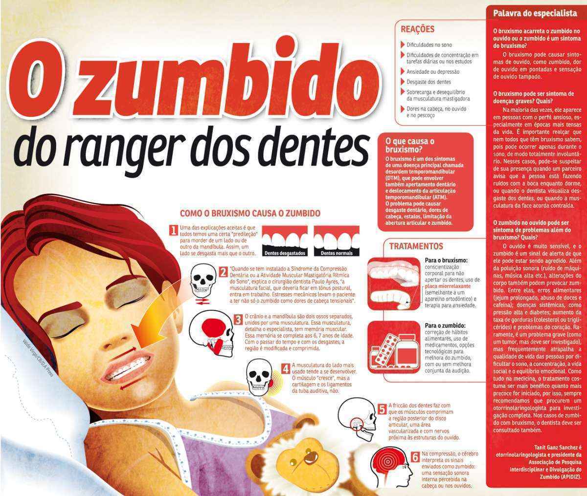 Barulhos no ouvido? Pode ser a Articulação temporomandibular – Dr