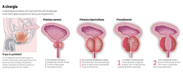 Clique para ampliar e entender mais sobre a pesquisa