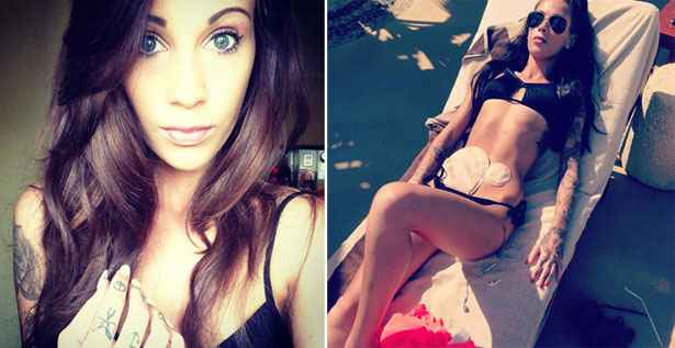 Stunning brunette bravely posts first-ever bikini picture exposing her  colostomy bags – New York Daily News