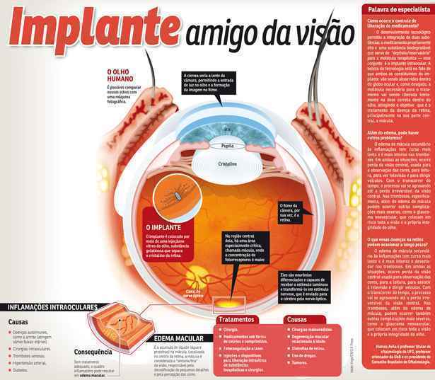 Clique na imagem para ampliá-la e saiba mais