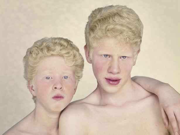 Gustavo Lacerda/Livro 'Albinos'