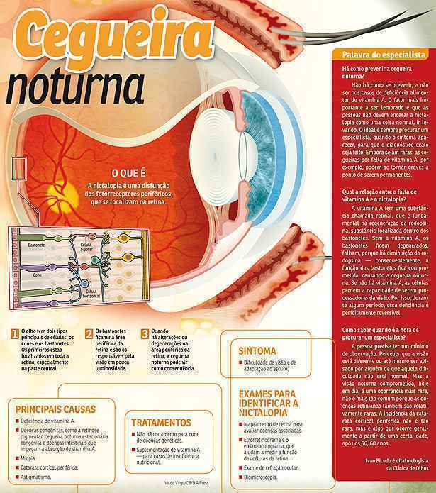 Causas da cegueira: doenças que provocam perda de visão - Clínica Tibiriça