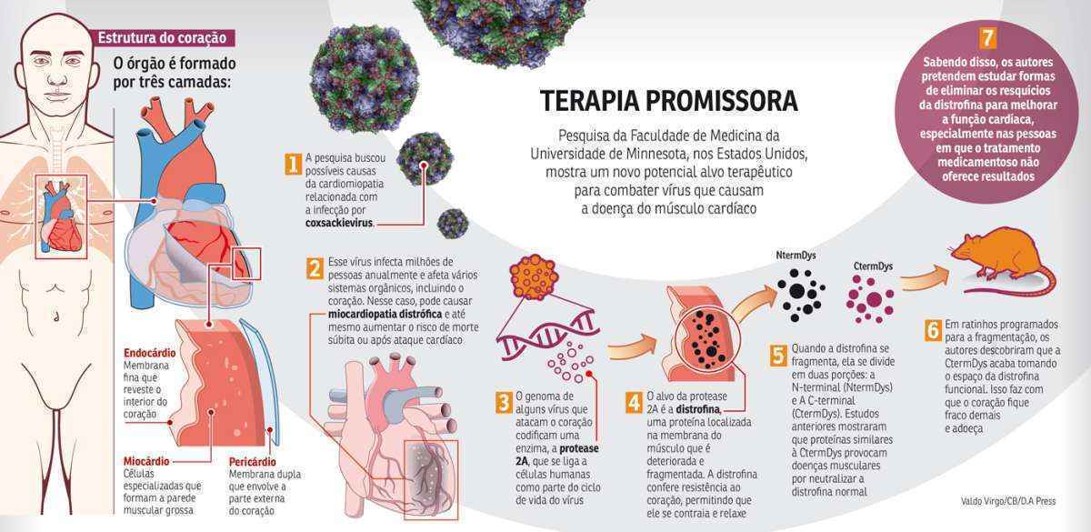 Endocardio - Esses sintomas combinados, podem ser indicativos