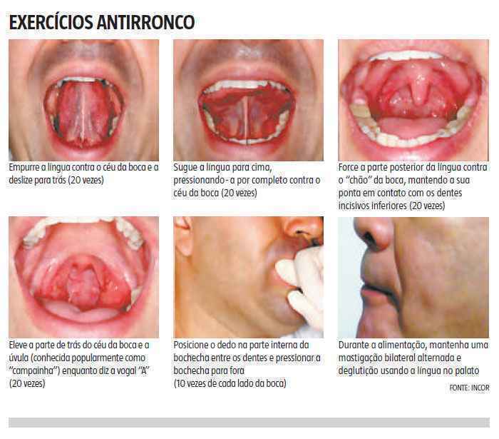 Cáseos: saiba como prevenir as desagradáveis 'pedrinhas' que se