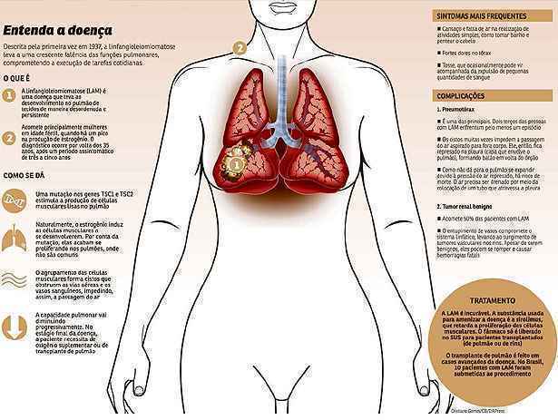 Clique na imagem para ampliá-la e saiba mais