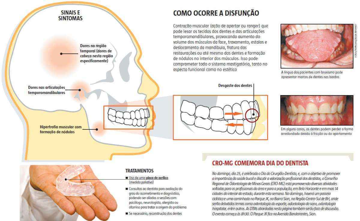 DTM: Entenda o que é a disfunção da Articulação Temporomandibular - Atelier  Dental