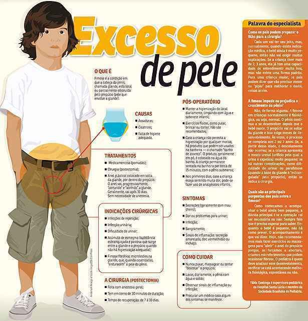 Bastante Comum Fimose Infantil E Natural Mas Pode Ocasionar Infeccoes Uai Saude Bastante Comum Fimose Infantil E Natural Mas Pode Ocasionar Infeccoes Uai Saude