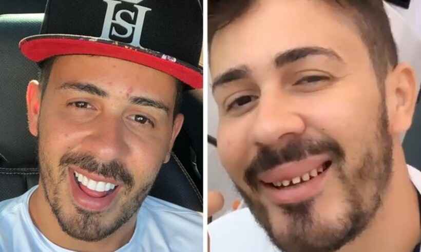 Kevinho Compartilha Fotos Dos Dentes Sem Lentes E Diverte Internautas