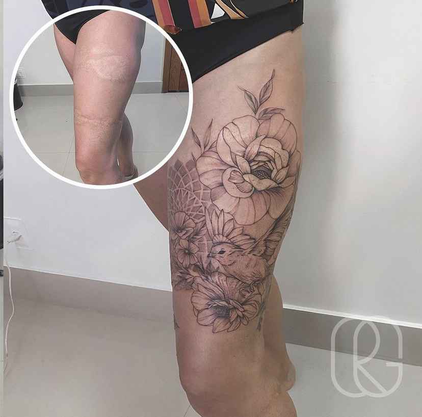 Camuflagem X Tatuagem Entenda Porque Em Casos Mais Graves A Tatuagem E Mais Indicada Para A Cobertura De Cicatrizes Mf Press Entretenimento